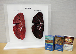 禁煙指導用肺モデル